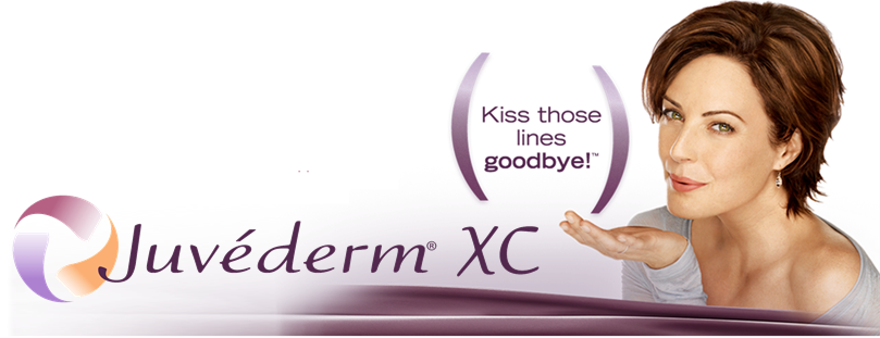 kiss-those-lines-goodbye-with-juvederm-xc-from-platinum-mobile-medspa